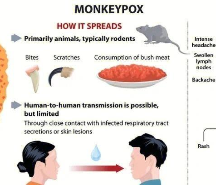 猴痘病毒病，一场悄然蔓延的全球健康挑战与应对策略