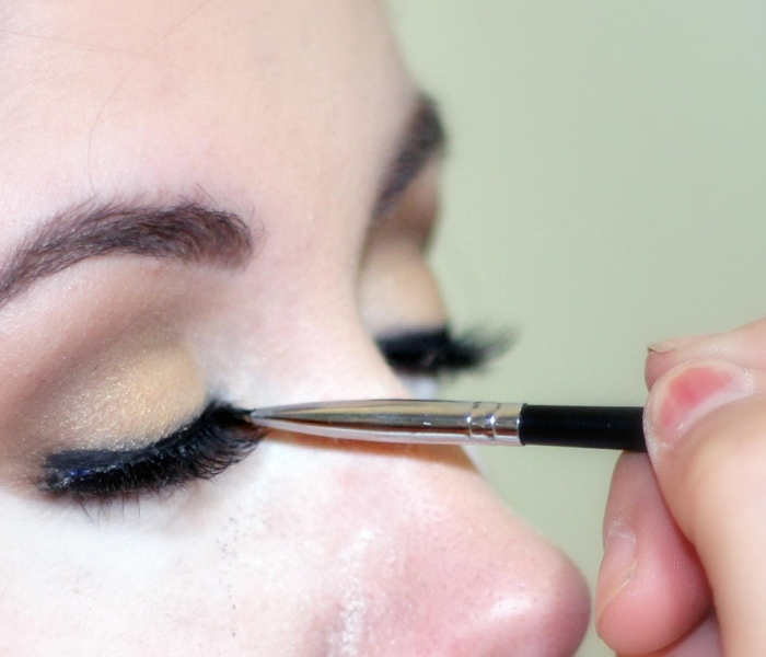 夫妻阳瘘的最佳治疗方法:夫妻阳瘘的最佳治疗方法是什么